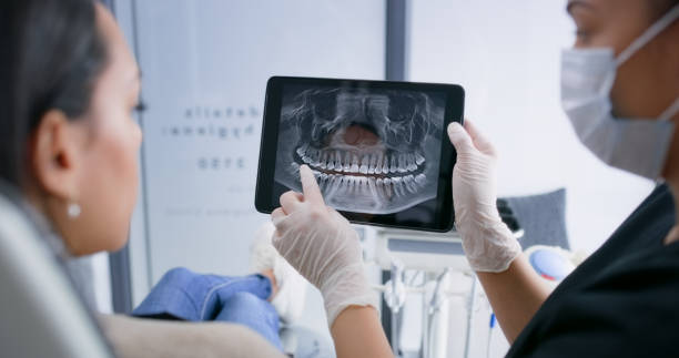 Best Knocked-Out Tooth (Avulsed Tooth) Treatment in San Miguel, CA